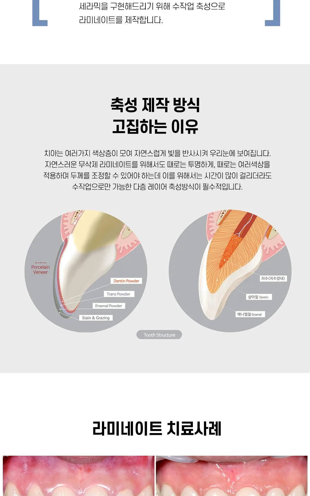 시술 상세 14