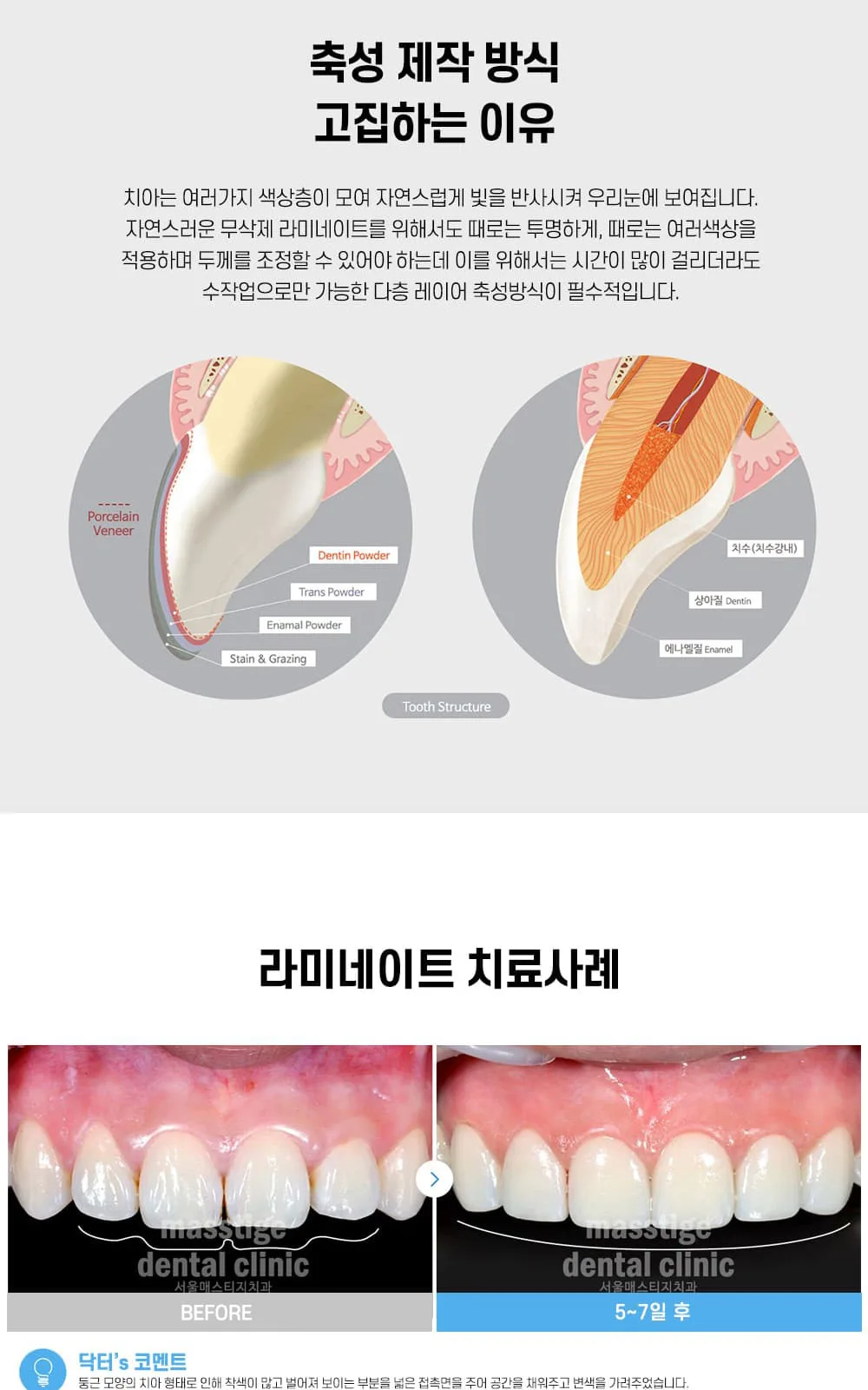 시술 상세 6