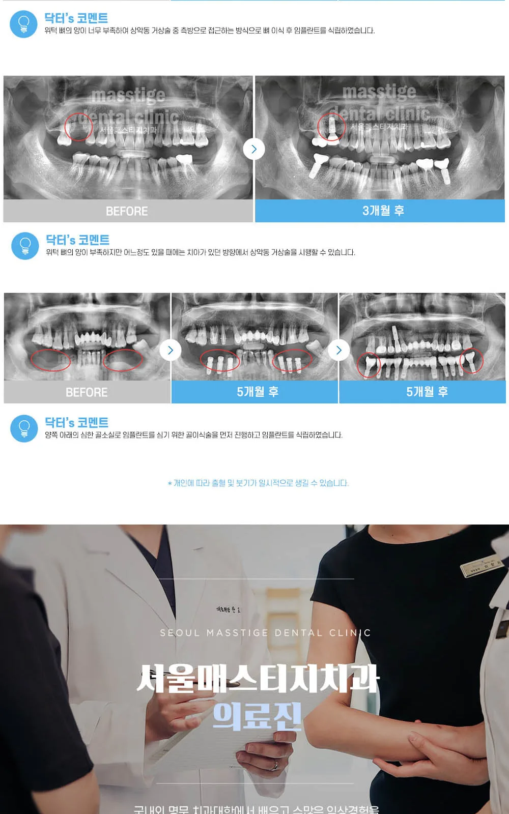 시술 상세 9