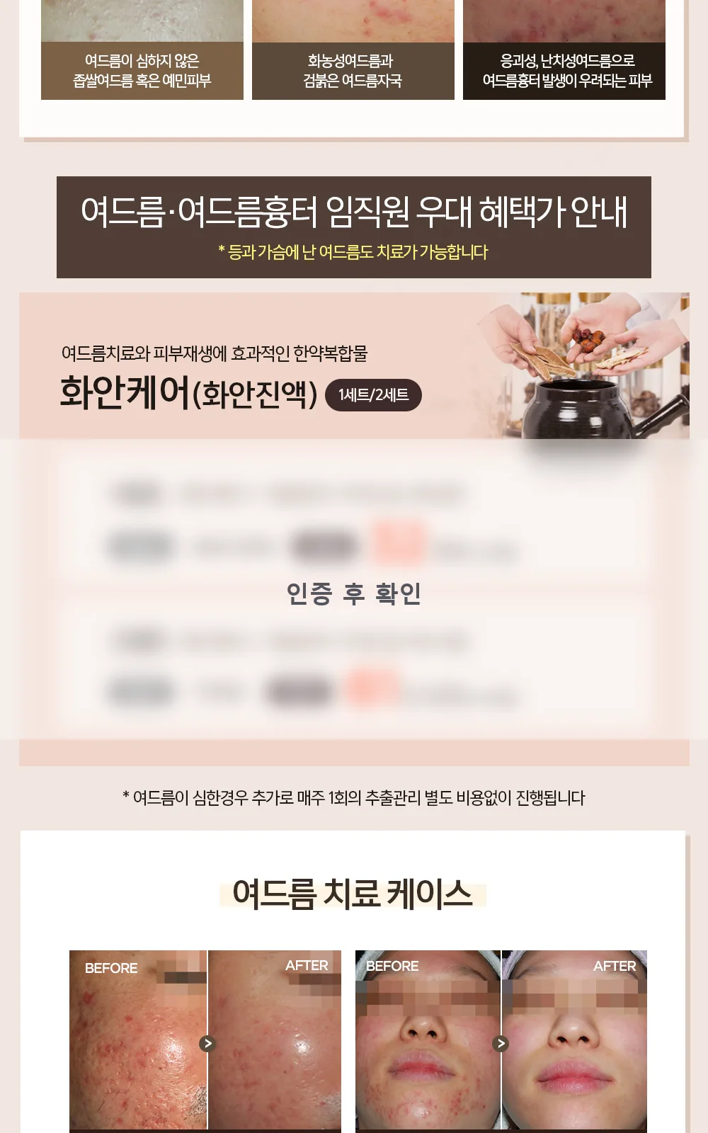 시술 상세 3