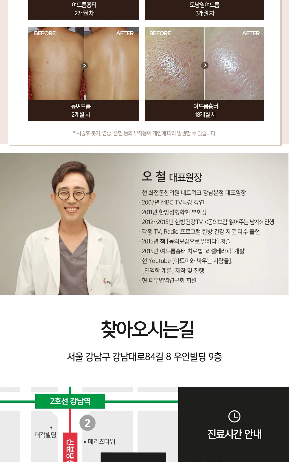 시술 상세 4