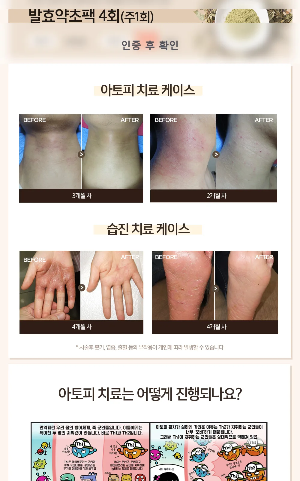 시술 상세 3