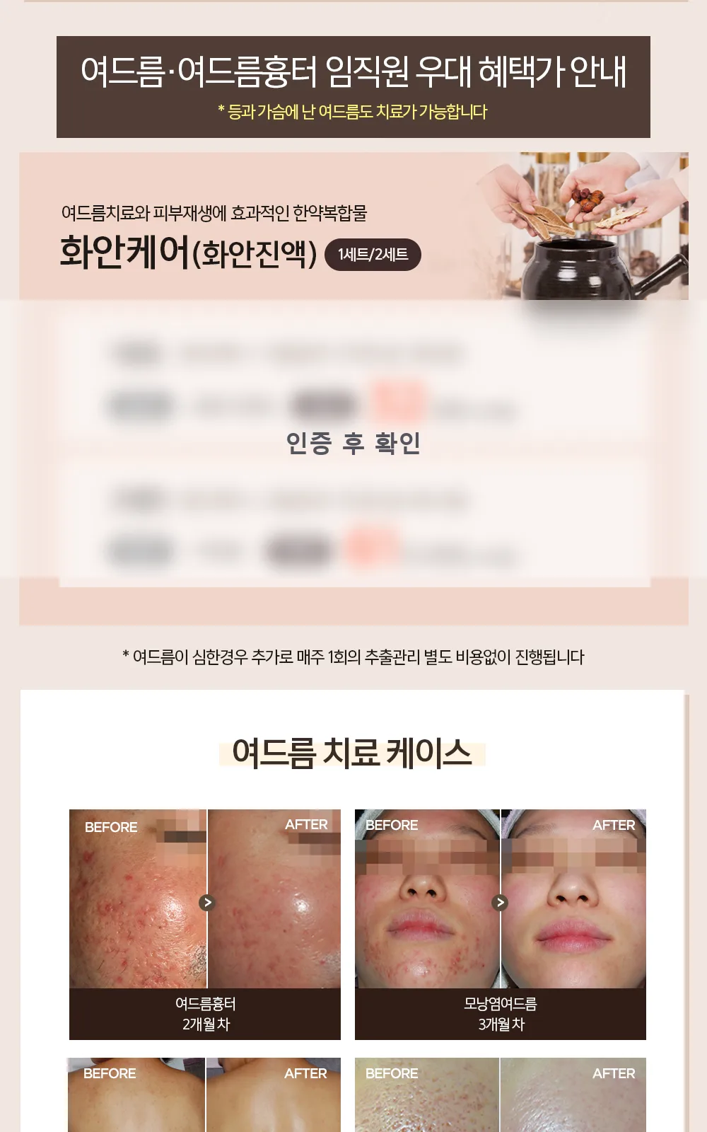 시술 상세 6