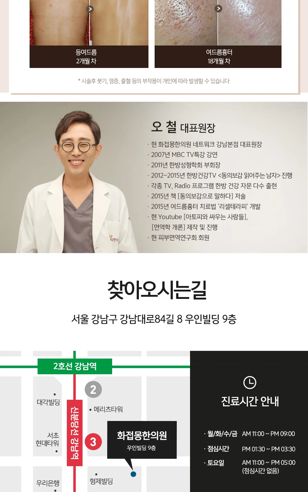 시술 상세 7