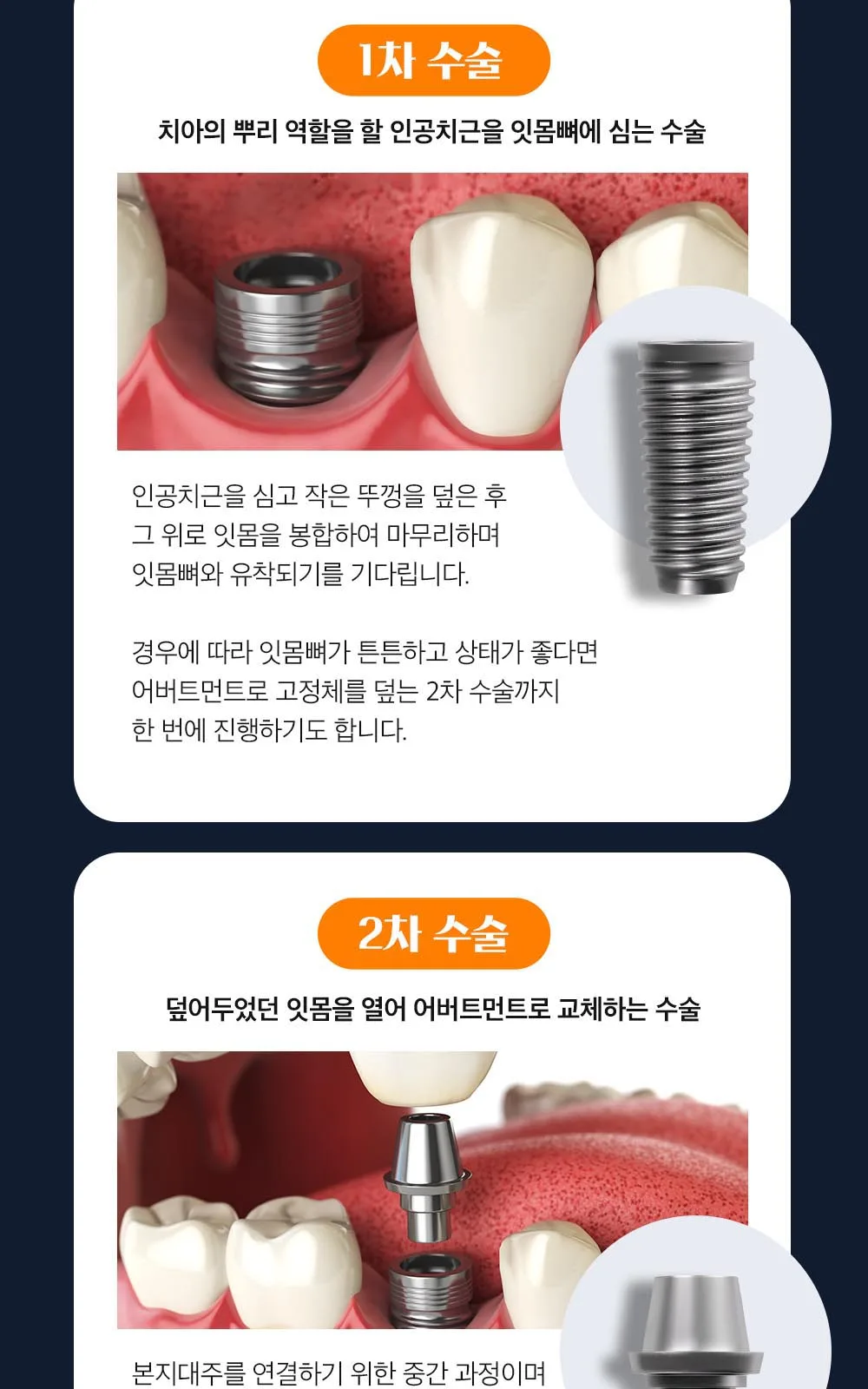 시술 상세 9