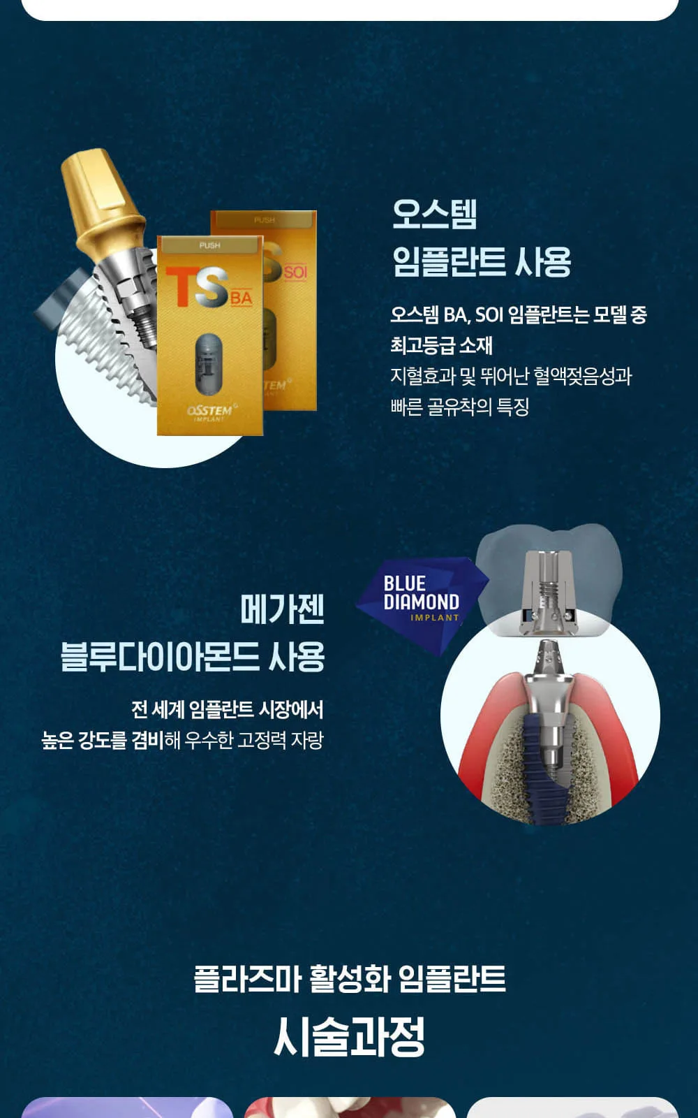 시술 상세 6