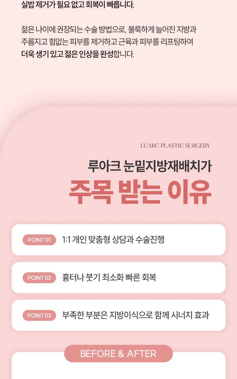 시술 상세 5