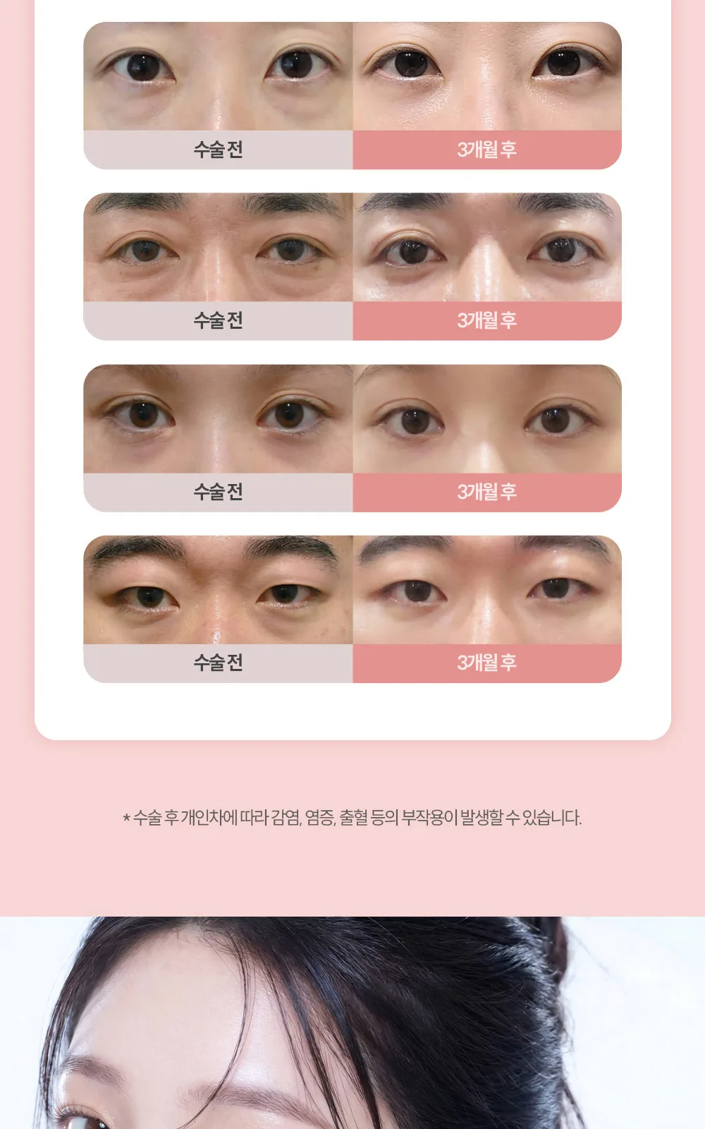 시술 상세 6