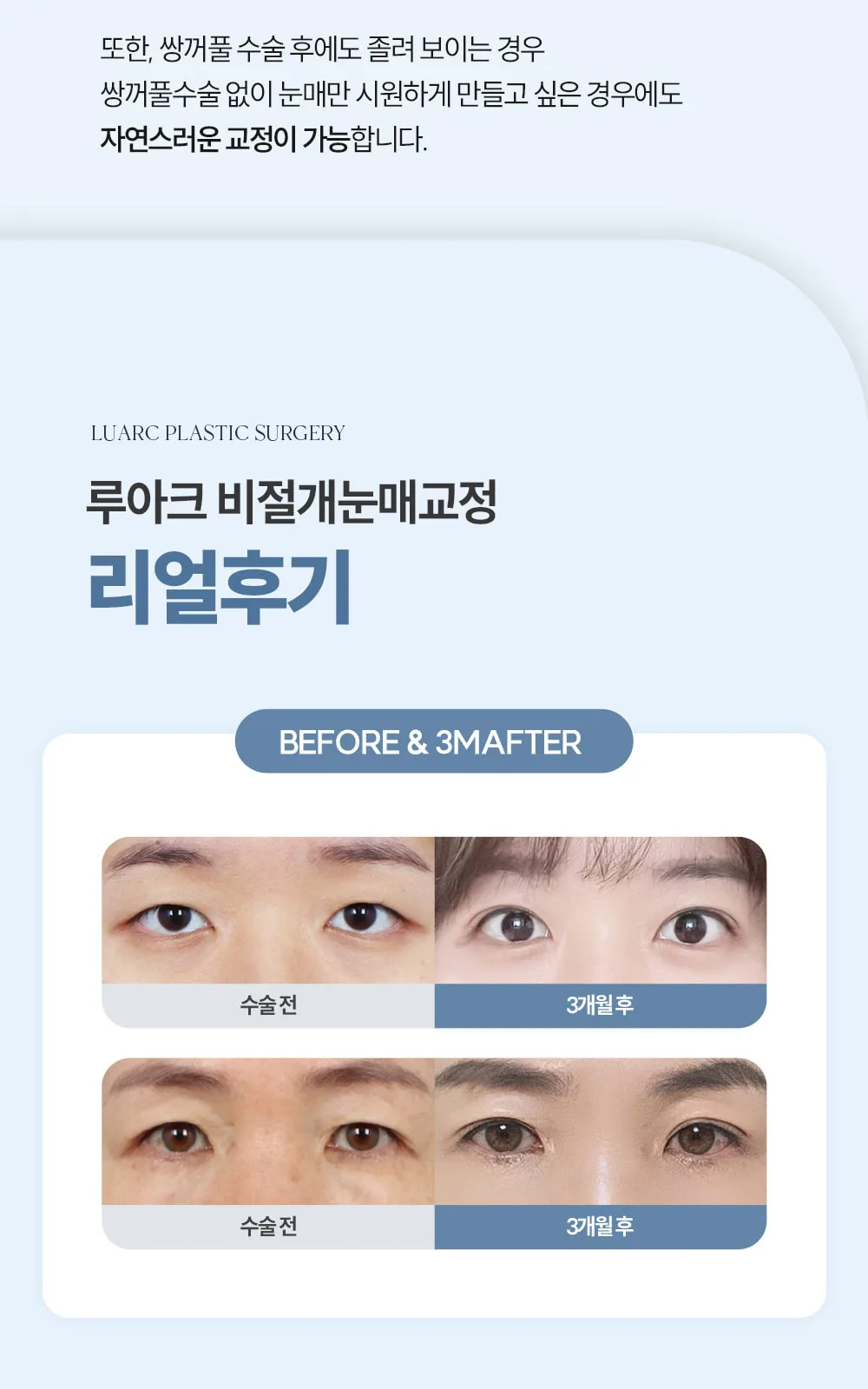 시술 상세 8