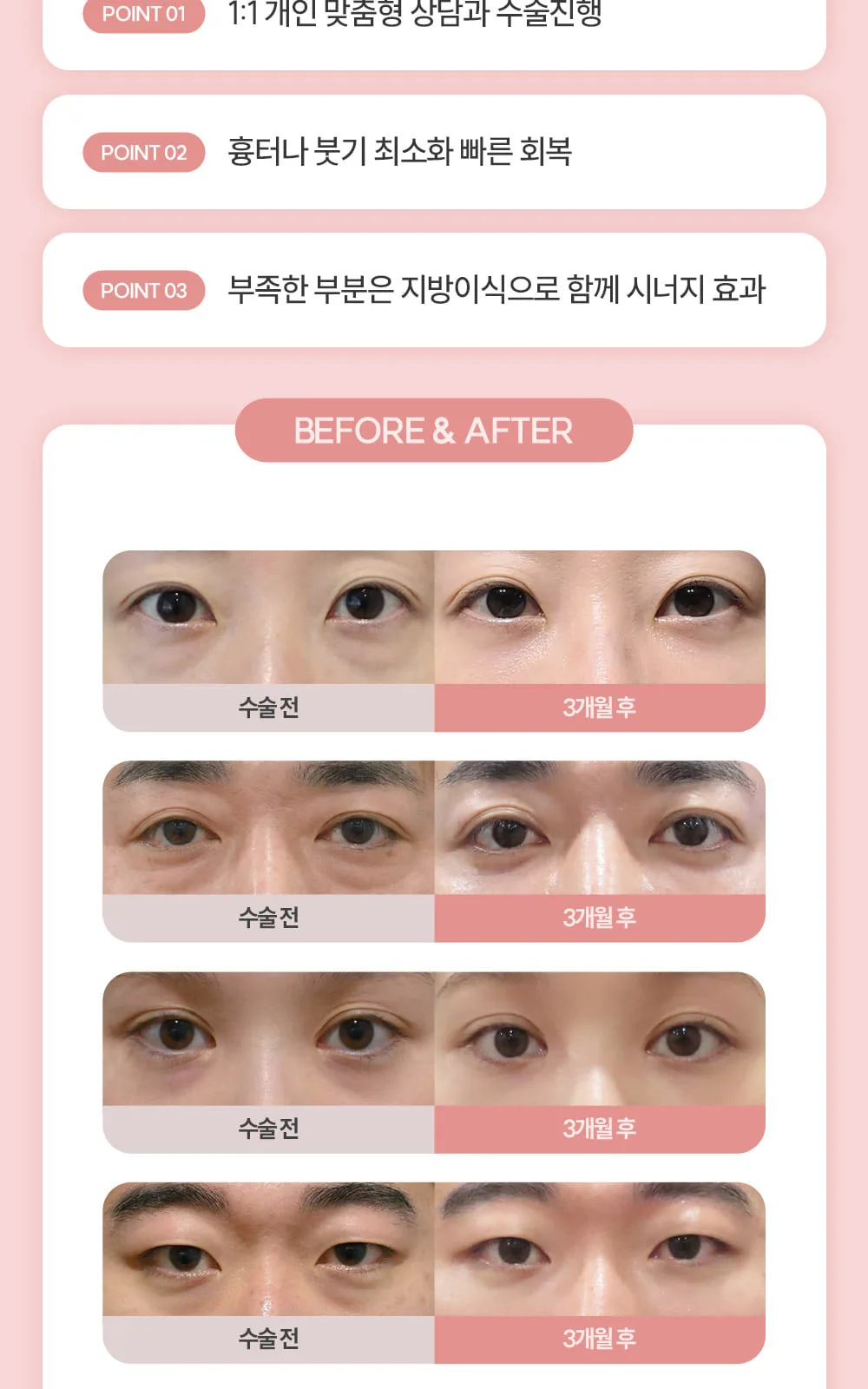 시술 상세 11