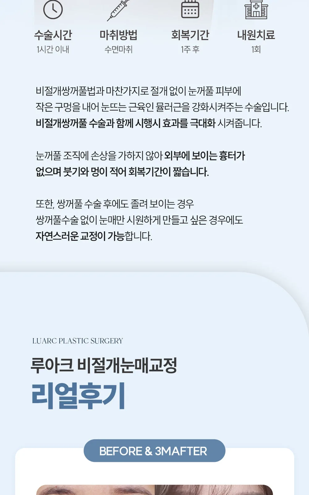 시술 상세 13