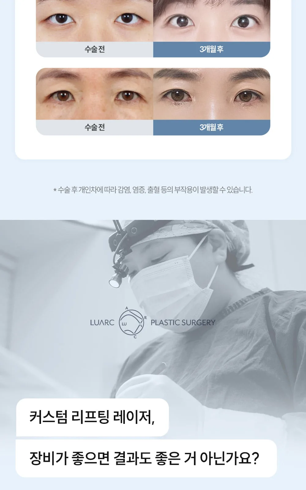 시술 상세 14