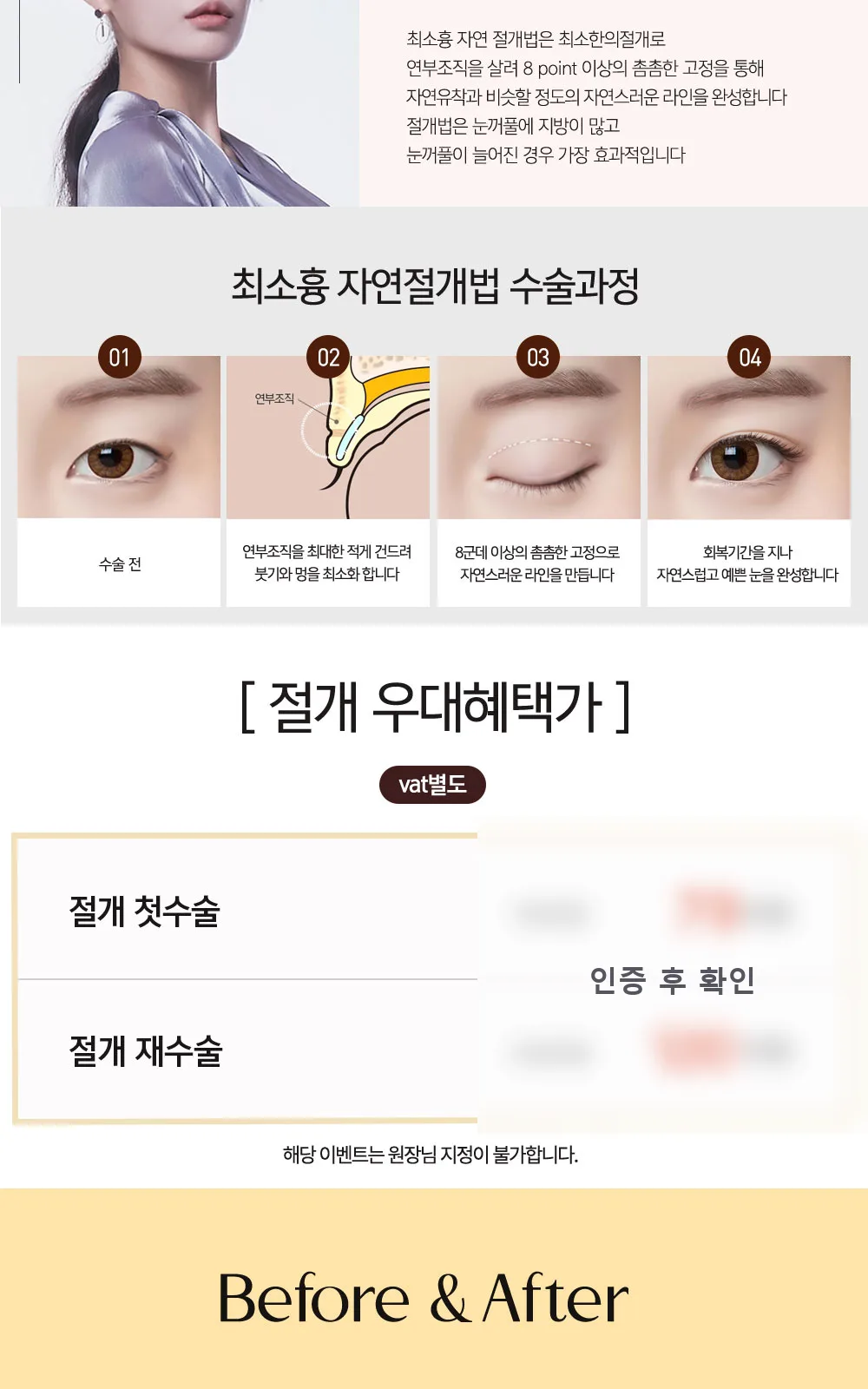 시술 상세 5