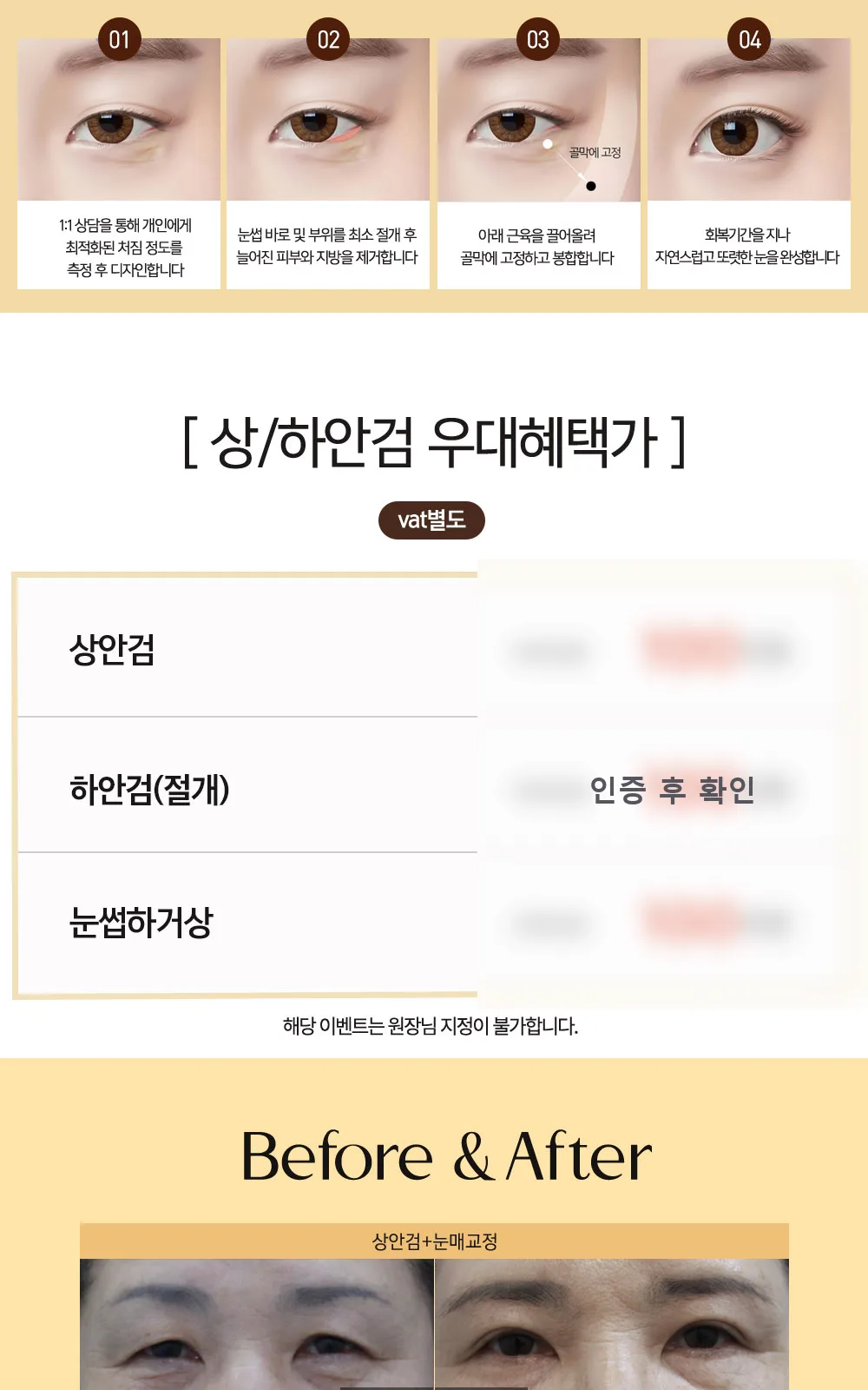 시술 상세 9