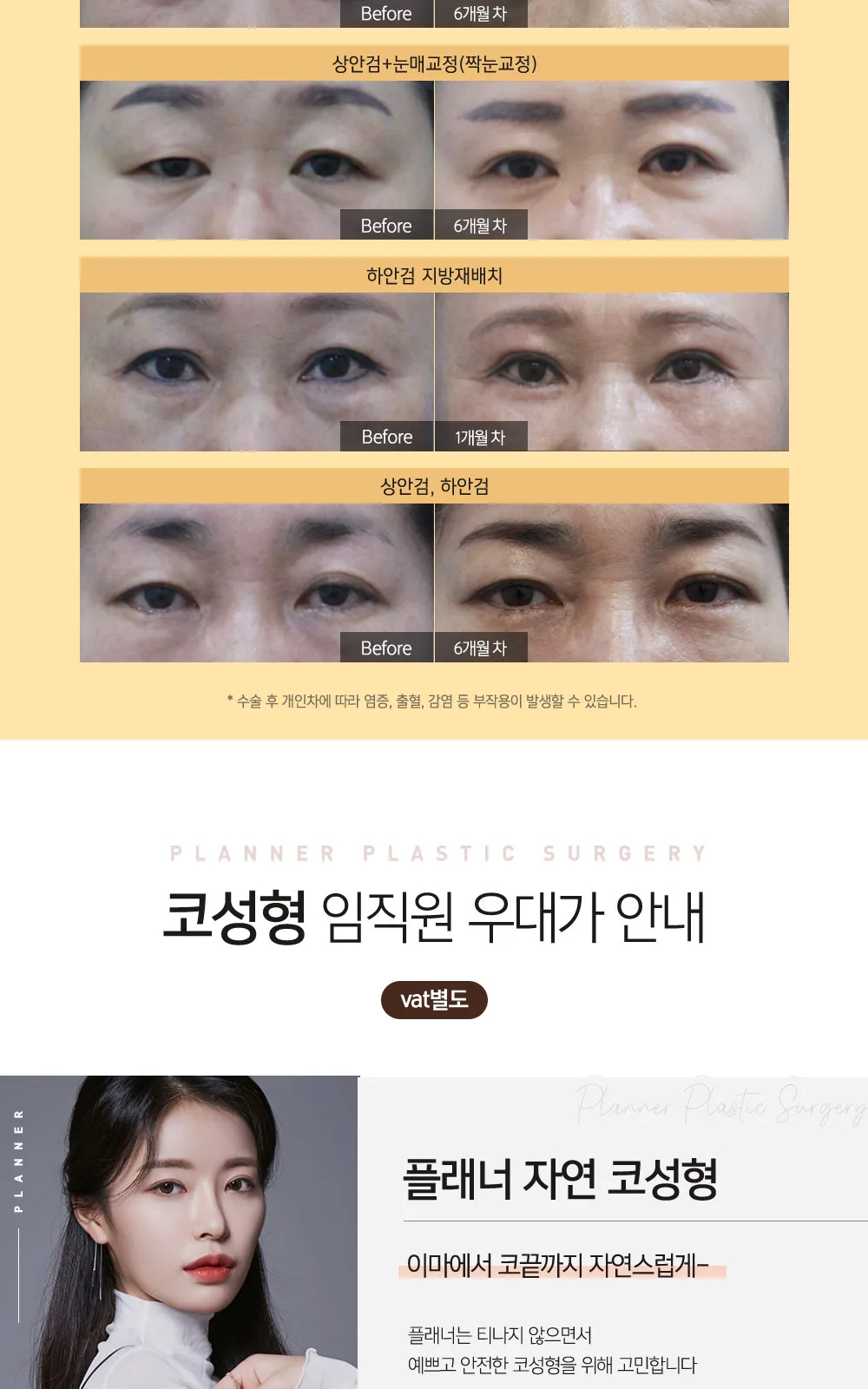 시술 상세 10