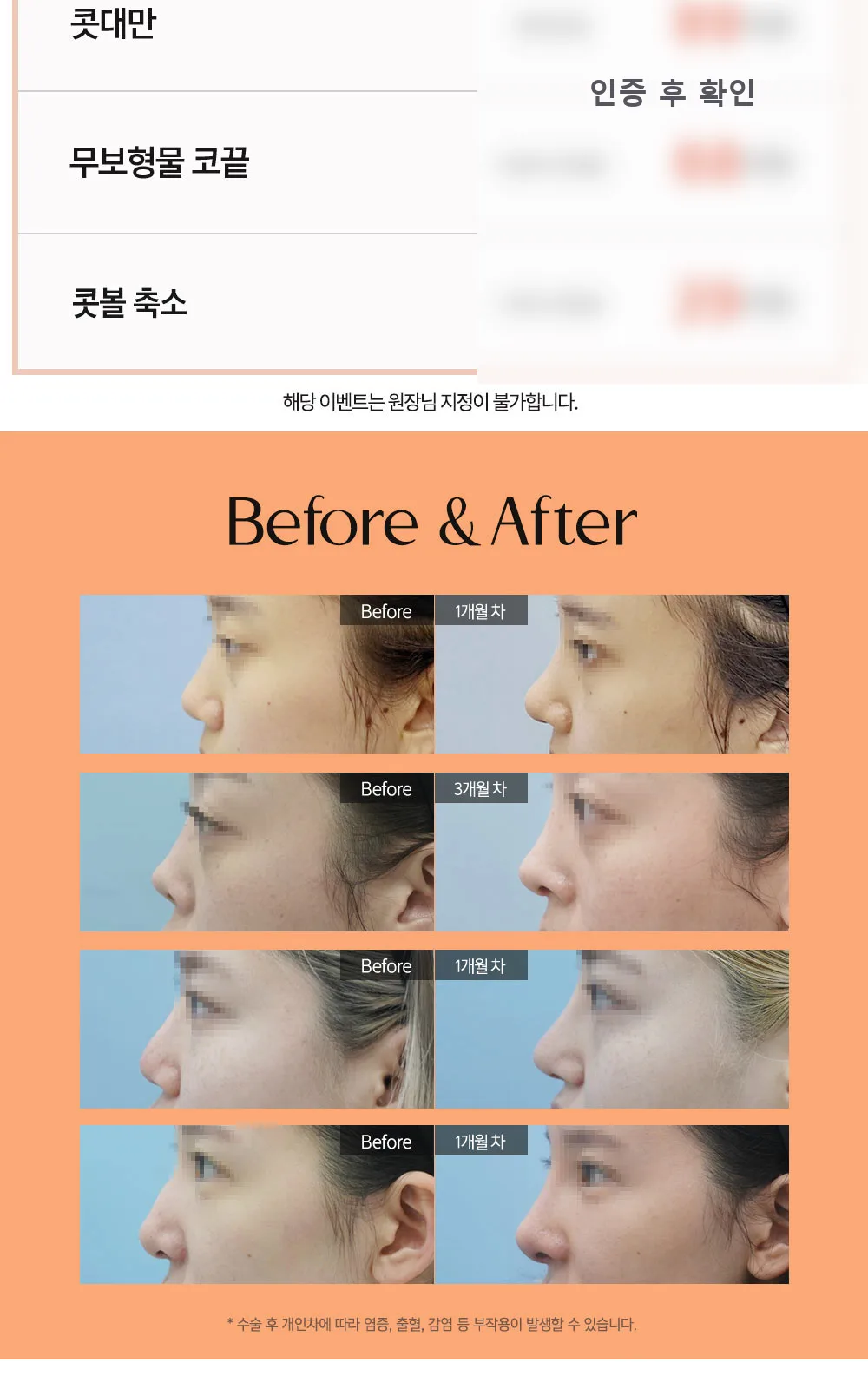 시술 상세 4