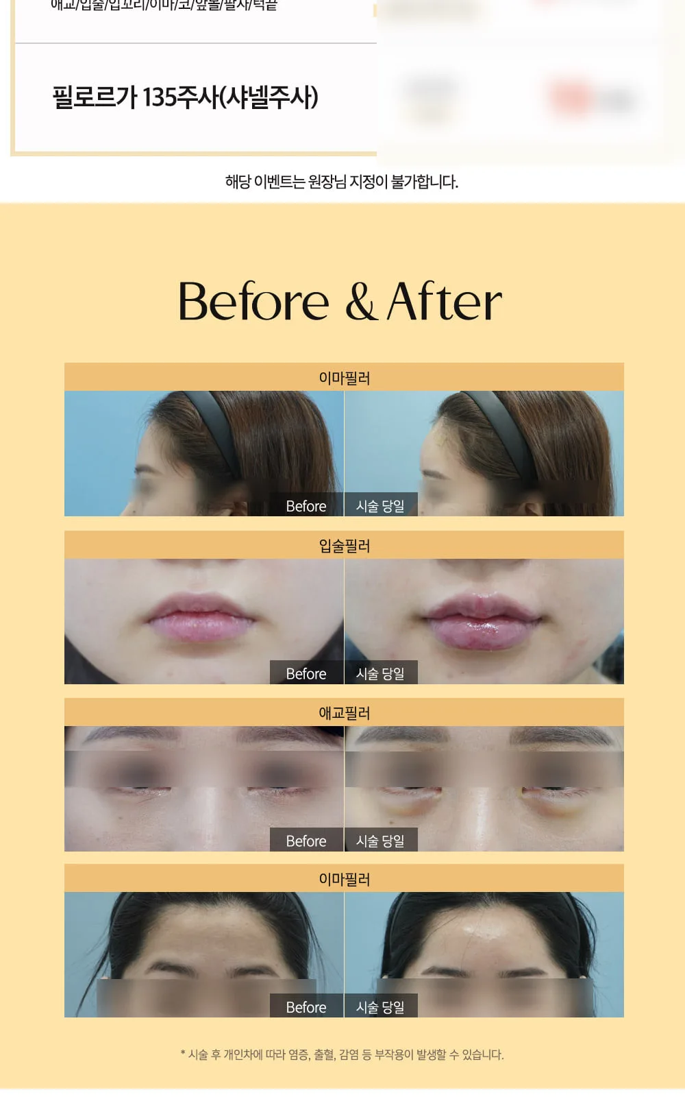 시술 상세 4