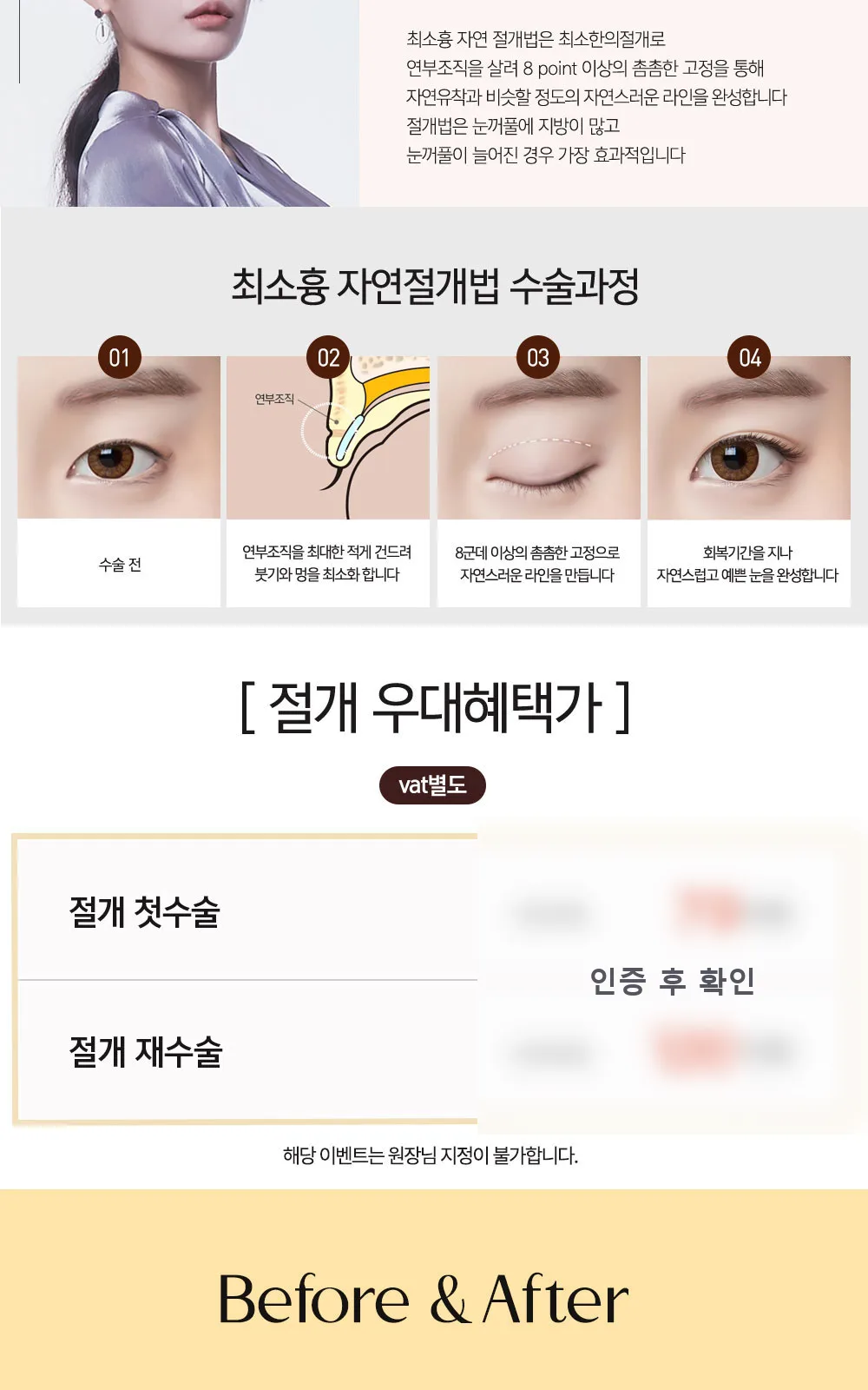 시술 상세 5