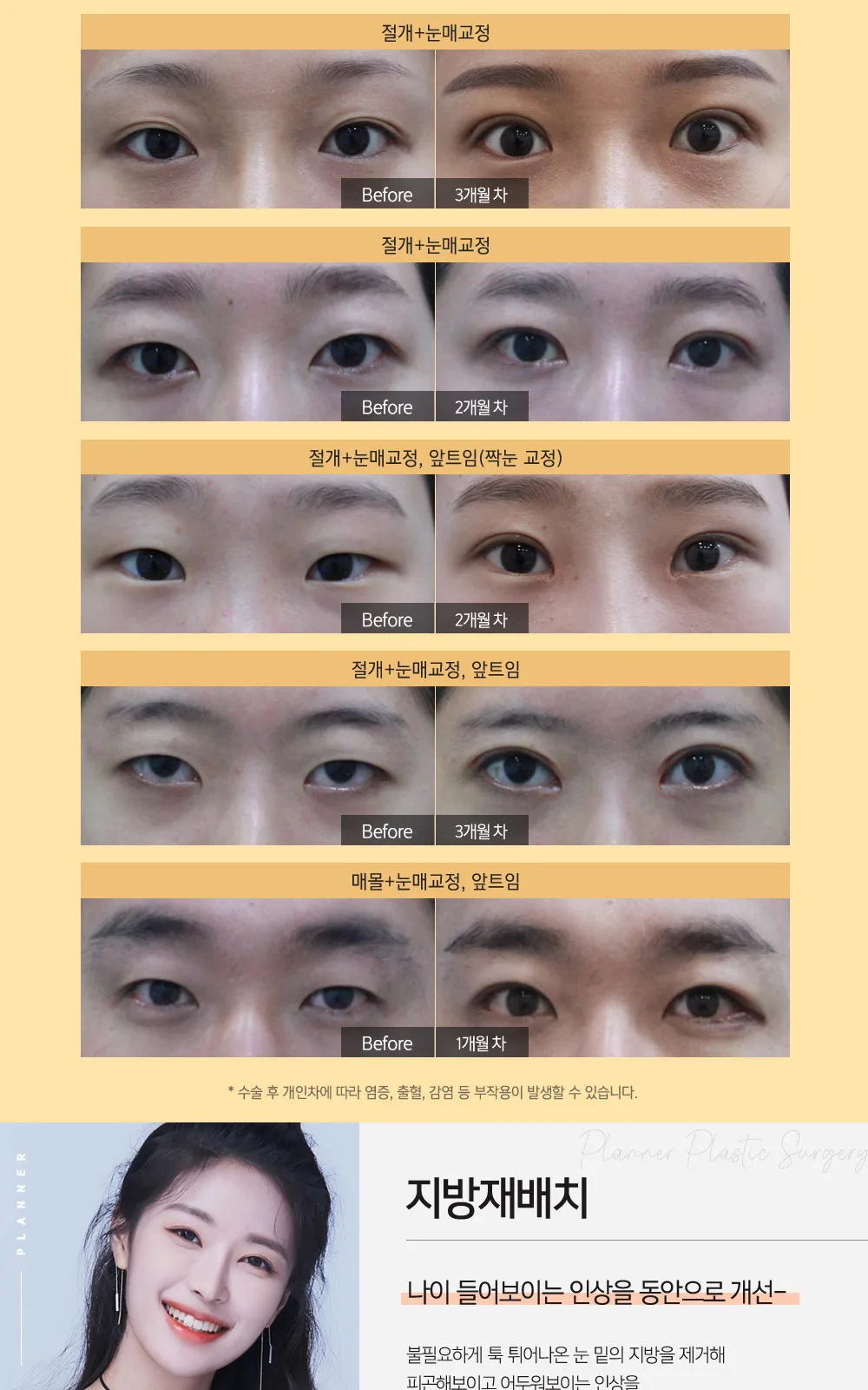 시술 상세 6