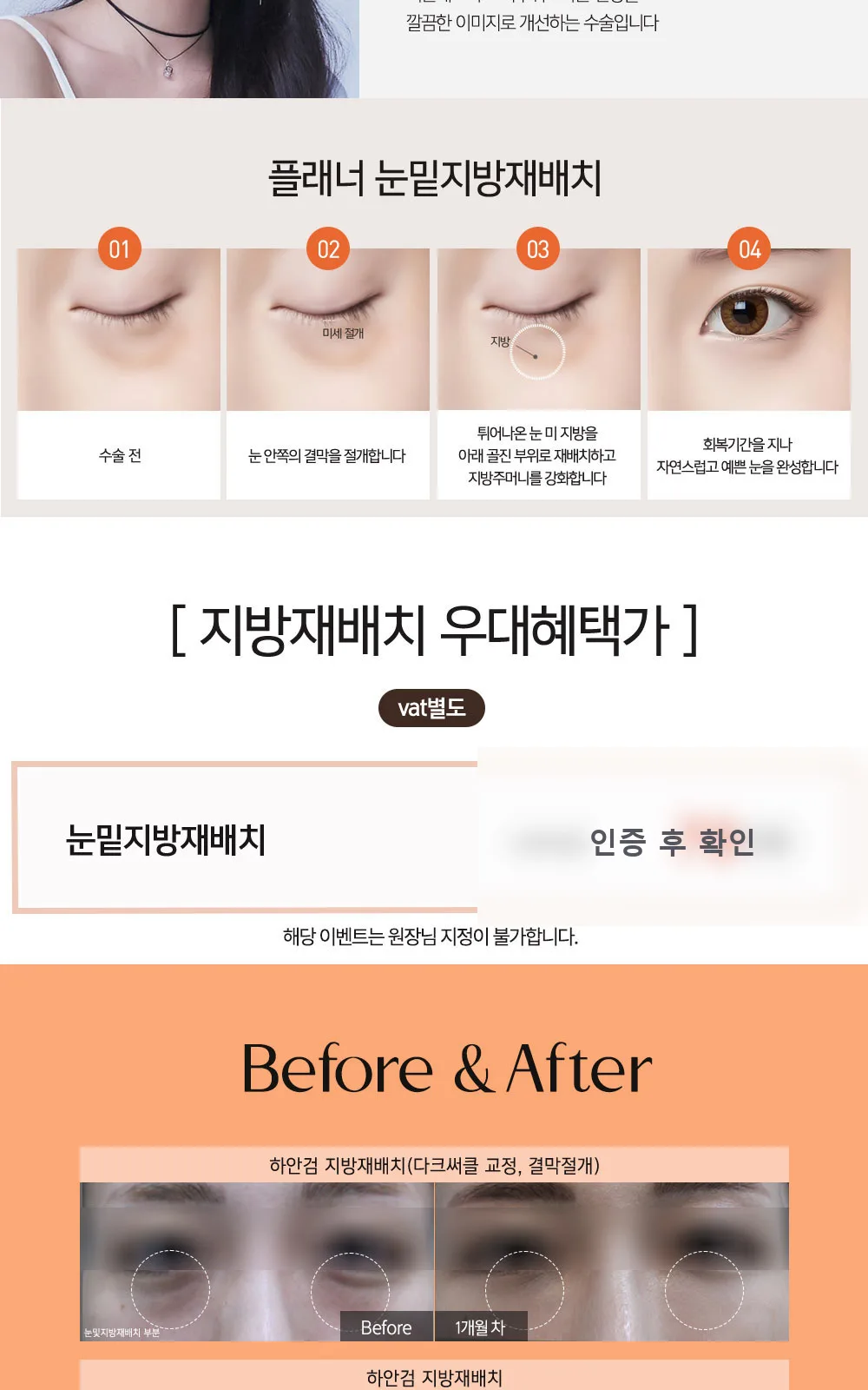 시술 상세 7