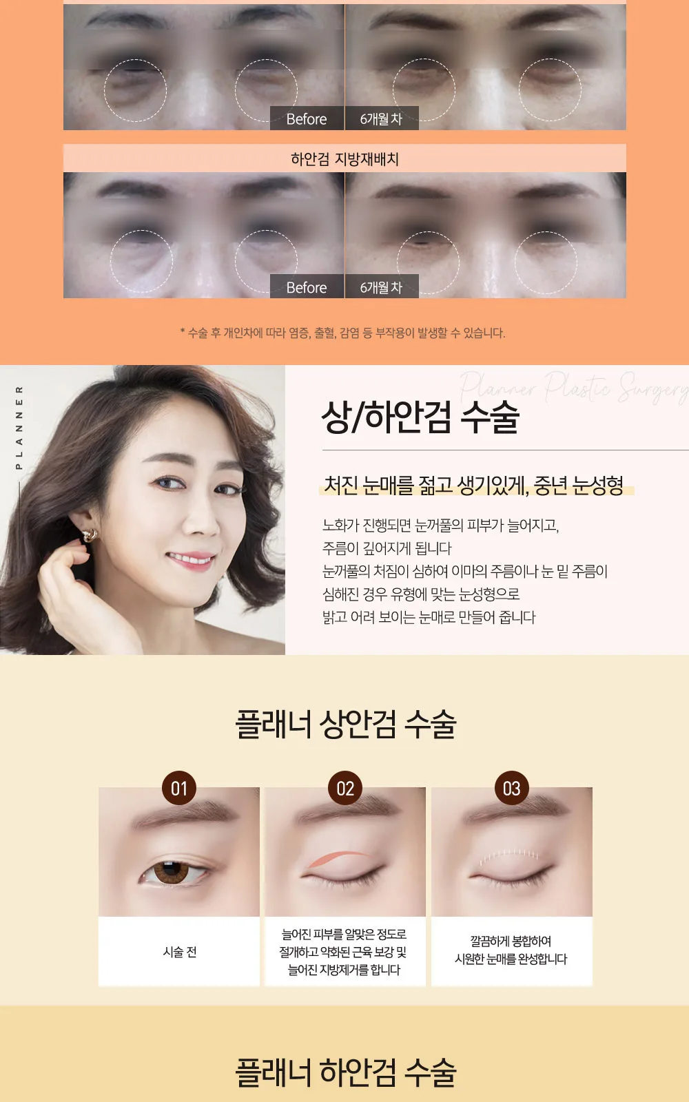 시술 상세 8