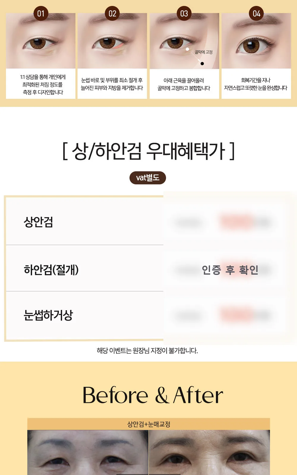 시술 상세 9