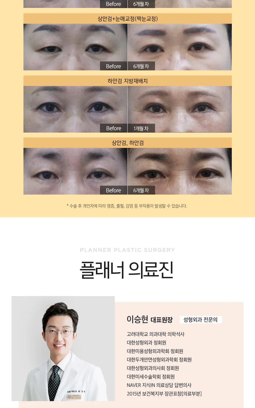 시술 상세 10